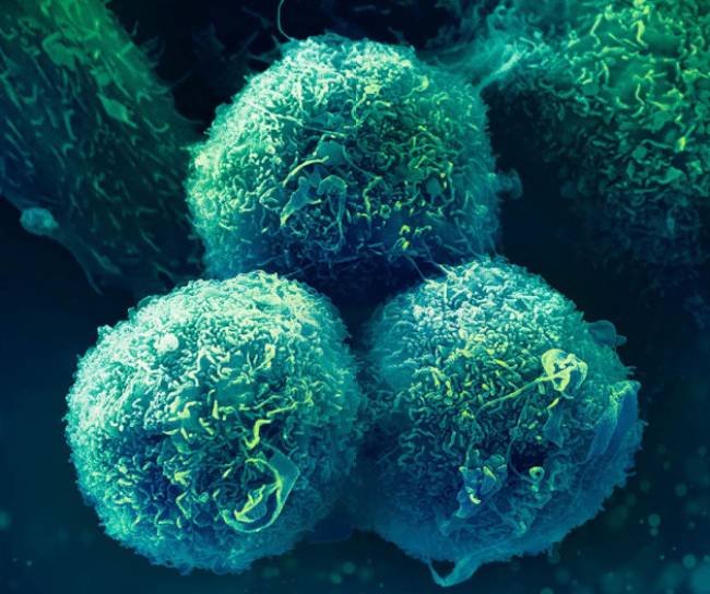 Imagen de células cancerígenas